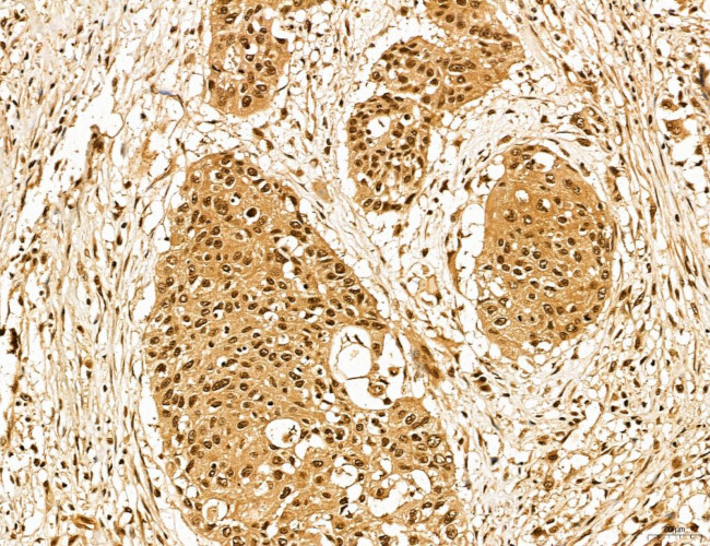 LZTFL1 Antibody in Immunohistochemistry (Paraffin) (IHC (P))