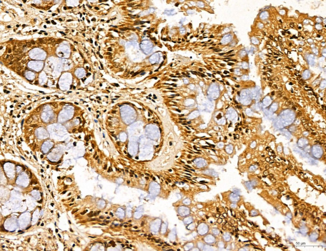 LZTFL1 Antibody in Immunohistochemistry (Paraffin) (IHC (P))