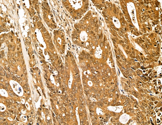 LZTFL1 Antibody in Immunohistochemistry (Paraffin) (IHC (P))