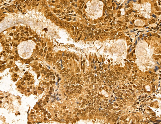 LZTFL1 Antibody in Immunohistochemistry (Paraffin) (IHC (P))