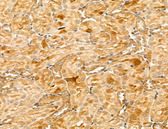 LZTFL1 Antibody in Immunohistochemistry (Paraffin) (IHC (P))