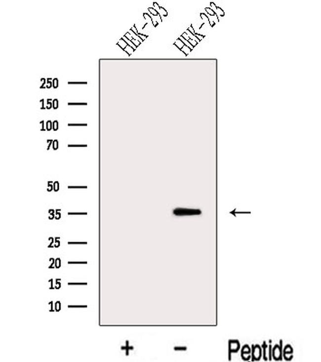 LZTFL1 Antibody in Western Blot (WB)