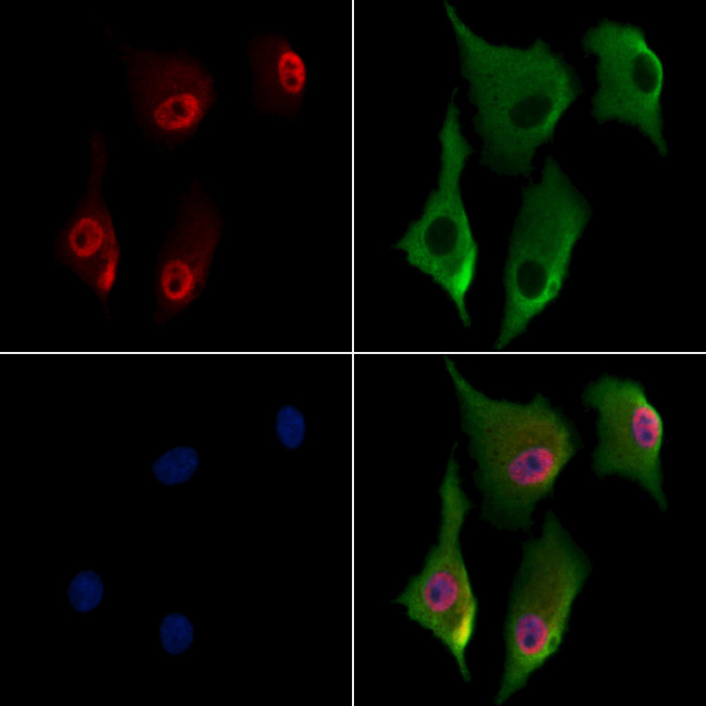 MAFK Antibody in Immunocytochemistry (ICC/IF)