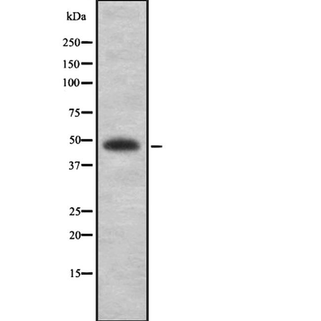 MAGE1 Antibody in Western Blot (WB)