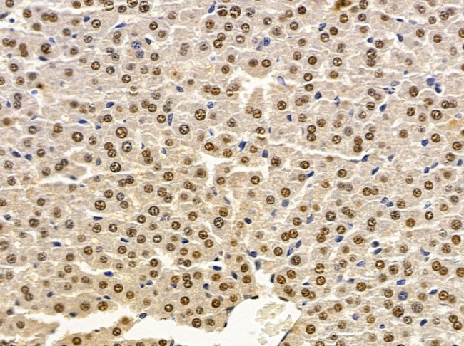 MAGEA4 Antibody in Immunohistochemistry (Paraffin) (IHC (P))