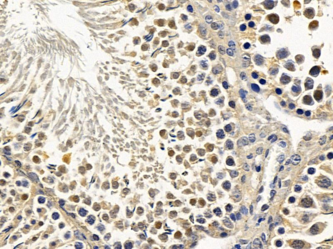 MAGEA4 Antibody in Immunohistochemistry (Paraffin) (IHC (P))