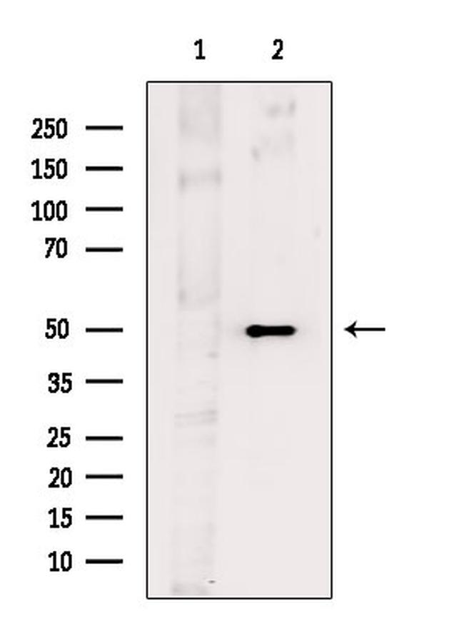 MAGEA4 Antibody in Western Blot (WB)