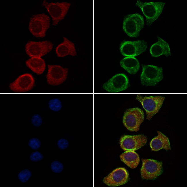 MAGEB1 Antibody in Immunocytochemistry (ICC/IF)