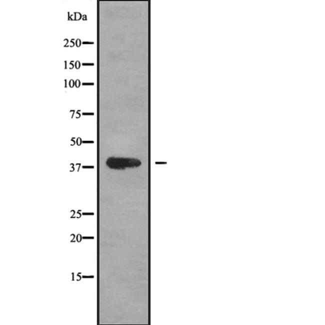 MAGEB1 Antibody in Western Blot (WB)