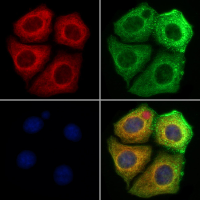 MAN2A1 Antibody in Immunocytochemistry (ICC/IF)