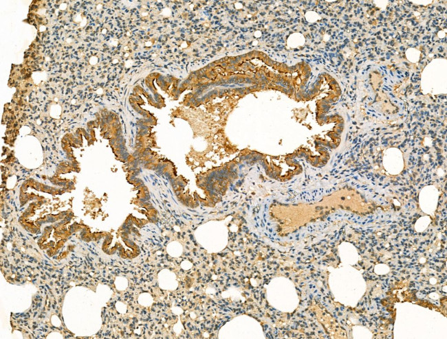 MAN2A1 Antibody in Immunohistochemistry (Paraffin) (IHC (P))