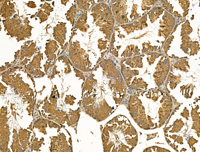 MAN2A1 Antibody in Immunohistochemistry (Paraffin) (IHC (P))