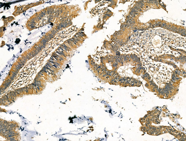 MAN2A1 Antibody in Immunohistochemistry (Paraffin) (IHC (P))