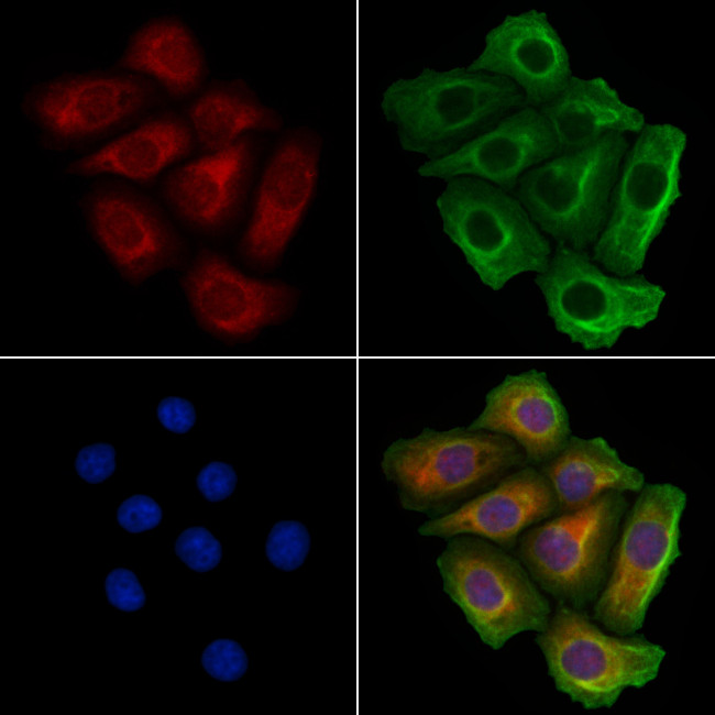 MARS Antibody in Immunocytochemistry (ICC/IF)