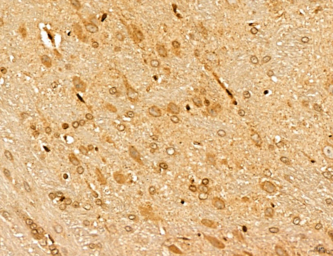 MARS Antibody in Immunohistochemistry (Paraffin) (IHC (P))