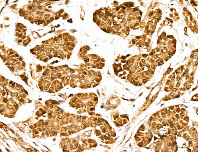 MARS Antibody in Immunohistochemistry (Paraffin) (IHC (P))