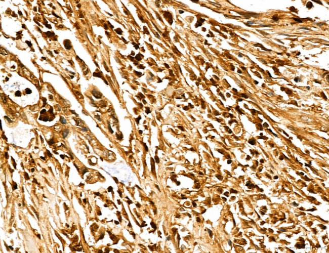 MARS Antibody in Immunohistochemistry (Paraffin) (IHC (P))