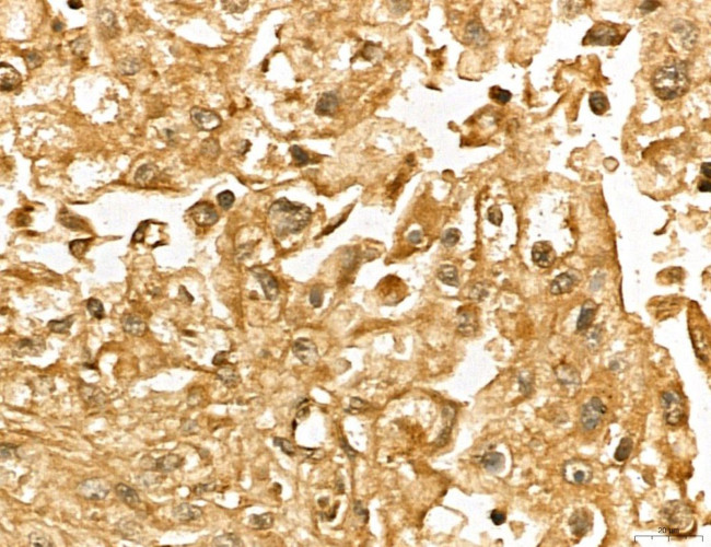 MARS Antibody in Immunohistochemistry (Paraffin) (IHC (P))