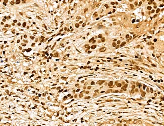 MARS Antibody in Immunohistochemistry (Paraffin) (IHC (P))