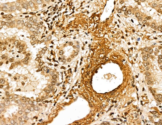 MARS Antibody in Immunohistochemistry (Paraffin) (IHC (P))