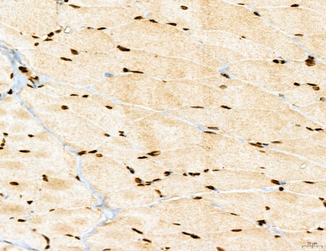 MARS Antibody in Immunohistochemistry (Paraffin) (IHC (P))