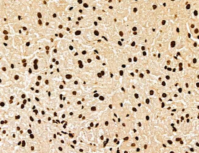 MARS Antibody in Immunohistochemistry (Paraffin) (IHC (P))