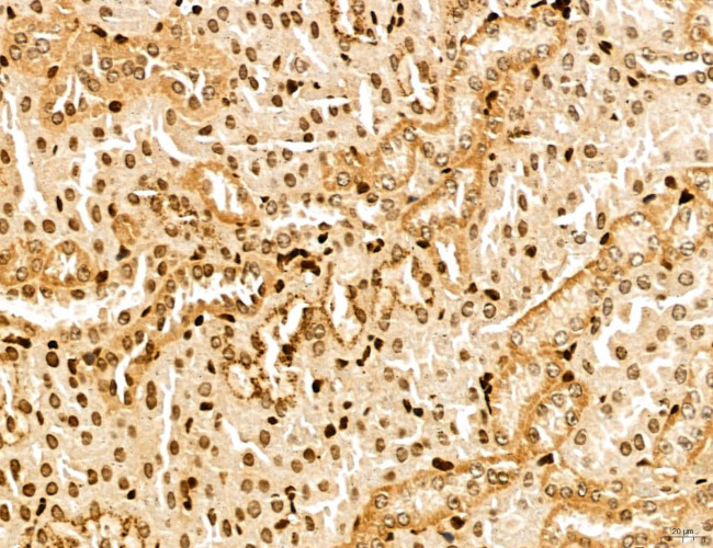 MARS Antibody in Immunohistochemistry (Paraffin) (IHC (P))