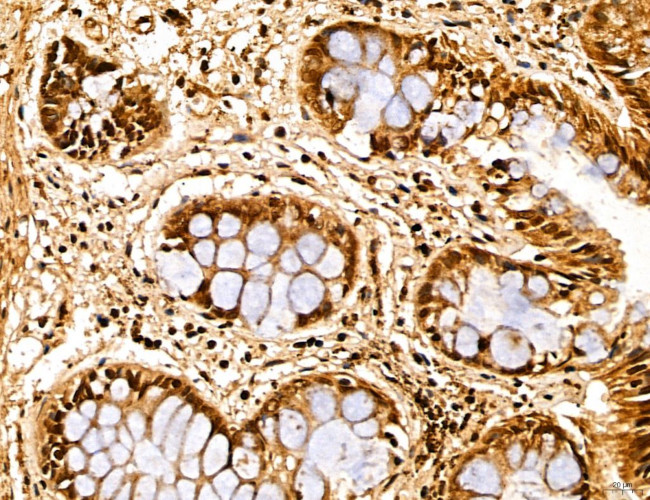 MARS Antibody in Immunohistochemistry (Paraffin) (IHC (P))