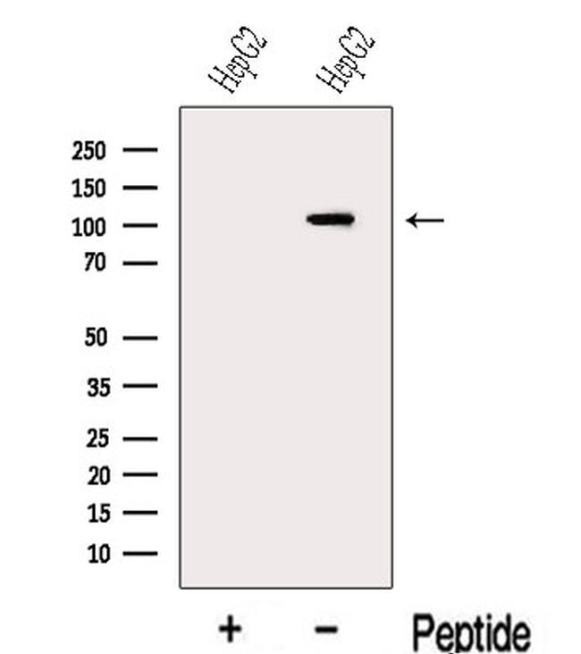 MARS Antibody in Western Blot (WB)