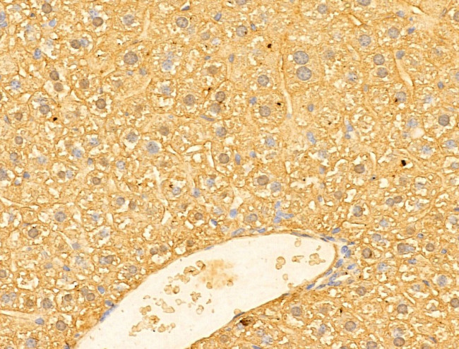 MAT1A Antibody in Immunohistochemistry (Paraffin) (IHC (P))