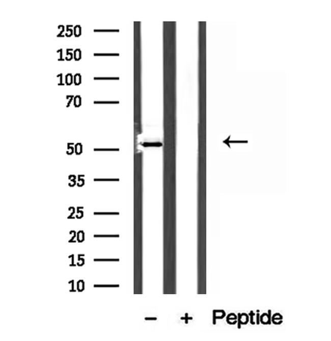 MAT1A Antibody in Western Blot (WB)