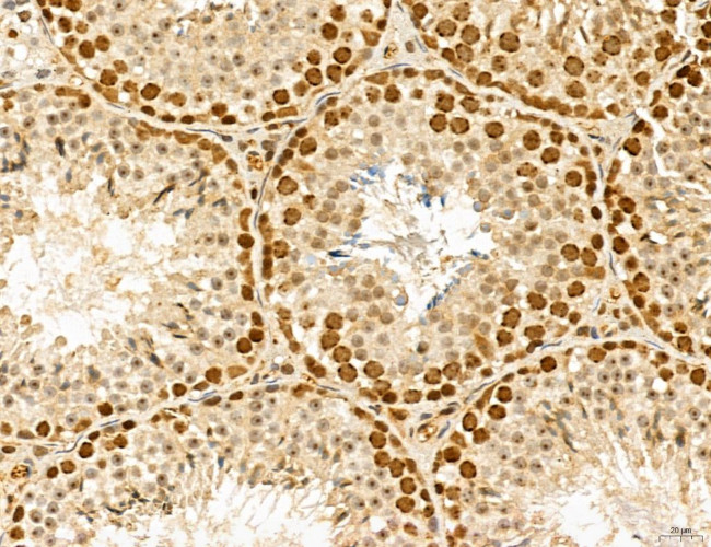 MAT2A Antibody in Immunohistochemistry (Paraffin) (IHC (P))