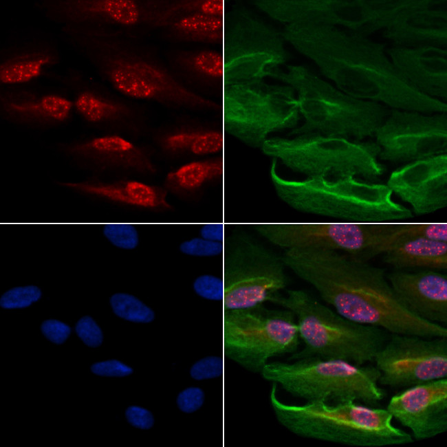 MBD2 Antibody in Immunocytochemistry (ICC/IF)