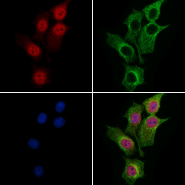 MBD4 Antibody in Immunocytochemistry (ICC/IF)