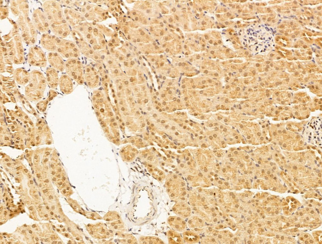 MBD4 Antibody in Immunohistochemistry (Paraffin) (IHC (P))