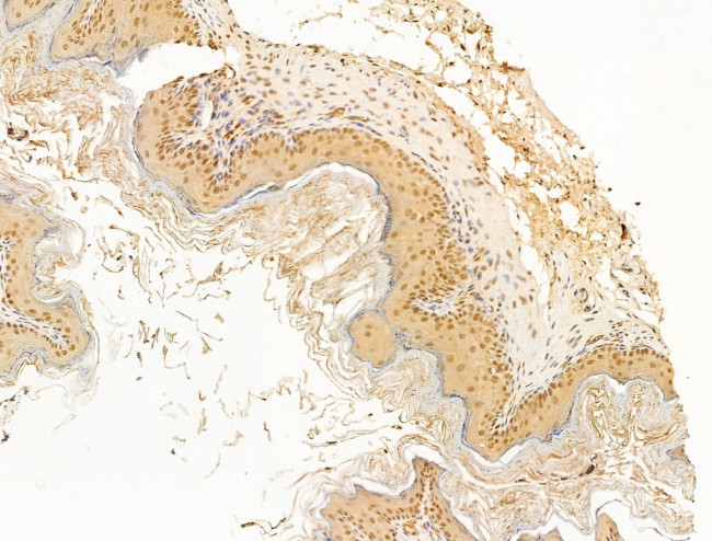 MBD4 Antibody in Immunohistochemistry (Paraffin) (IHC (P))