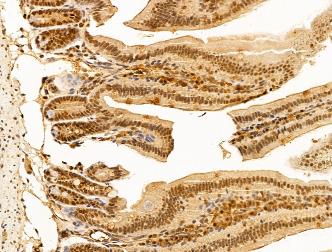 MBD4 Antibody in Immunohistochemistry (Paraffin) (IHC (P))