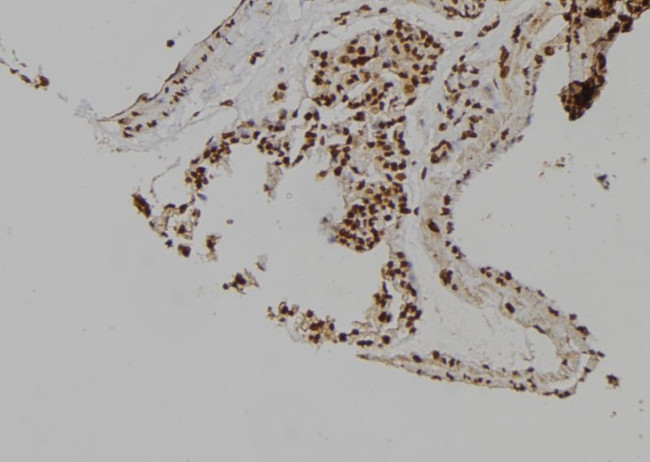 MCM6 Antibody in Immunohistochemistry (Paraffin) (IHC (P))