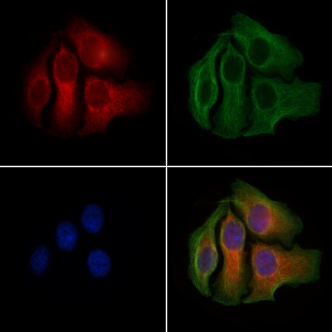 MCP-1 Antibody in Immunocytochemistry (ICC/IF)