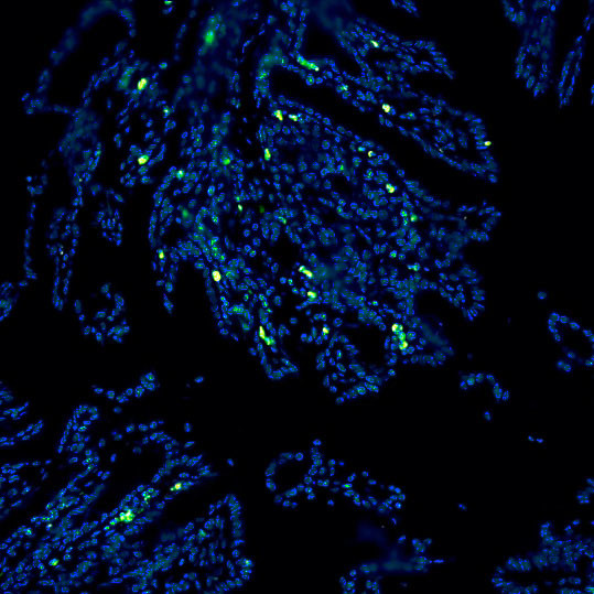 MCP-1 Antibody in Immunocytochemistry (ICC/IF)