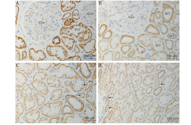 MCP-1 Antibody in Immunohistochemistry (Paraffin) (IHC (P))