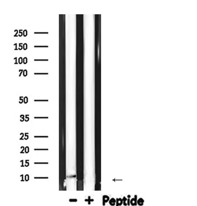 MCP-1 Antibody in Western Blot (WB)