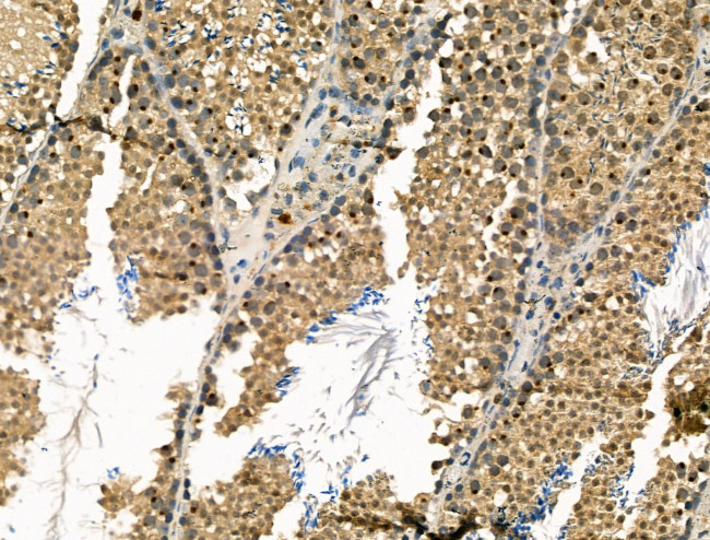 MDC1 Antibody in Immunohistochemistry (Paraffin) (IHC (P))