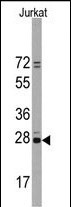 CD9 Antibody in Western Blot (WB)