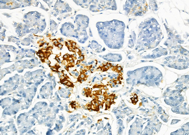 ME2 Antibody in Immunohistochemistry (Paraffin) (IHC (P))