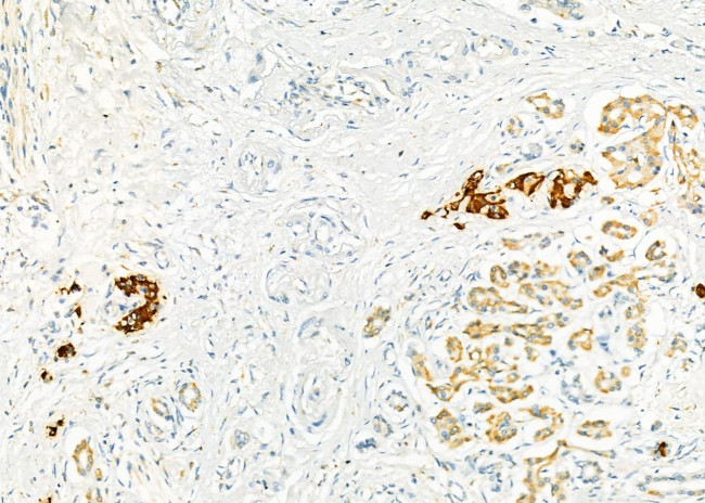 ME2 Antibody in Immunohistochemistry (Paraffin) (IHC (P))