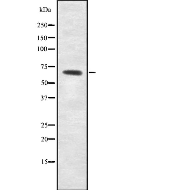 ME2 Antibody in Western Blot (WB)