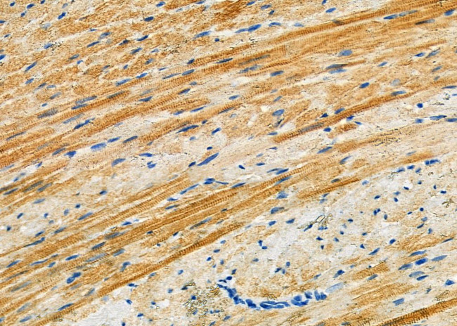 MID1IP1 Antibody in Immunohistochemistry (Paraffin) (IHC (P))