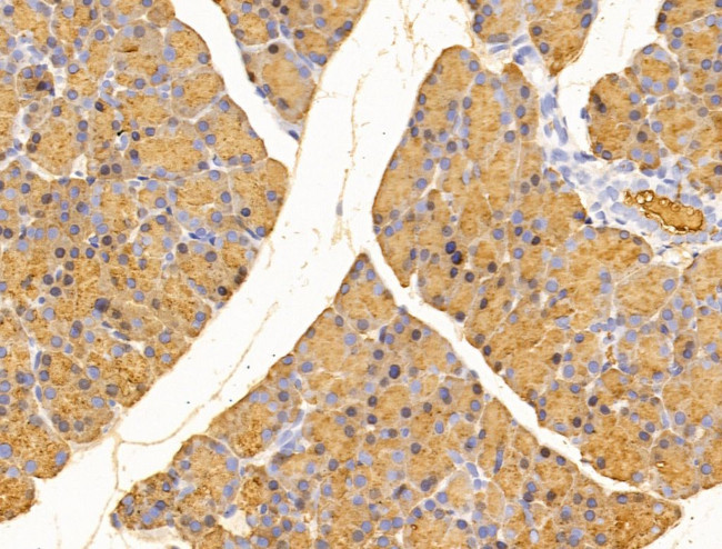 MIS12 Antibody in Immunohistochemistry (Paraffin) (IHC (P))