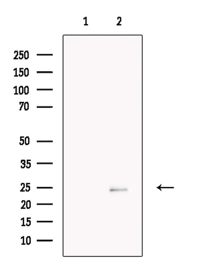 MIS12 Antibody in Western Blot (WB)